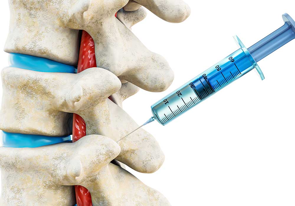 Facet Joint Injection And Medial Branch Blocks