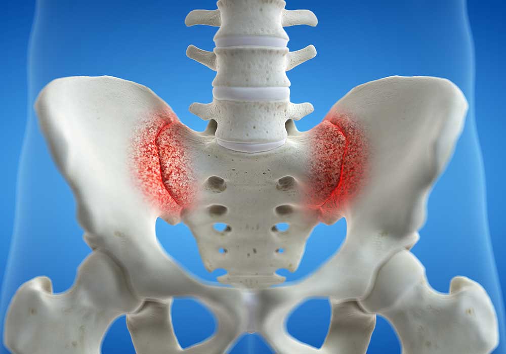 Sacroiliac (SI) Joint Injections
